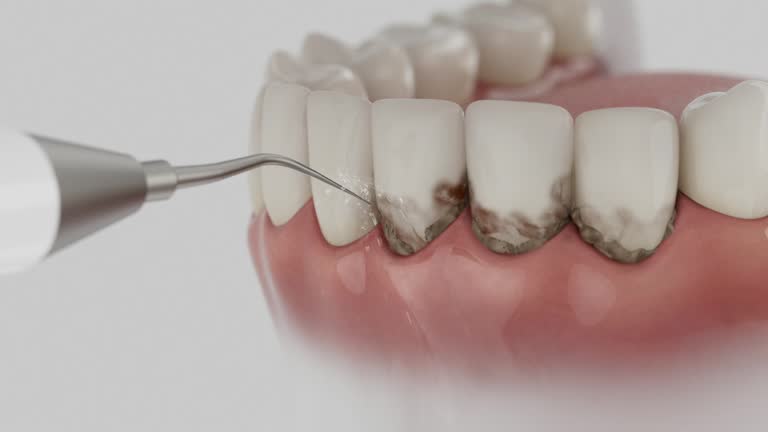 Trusted Dental Implants service in Maricopa, CA - Dentist Open Now